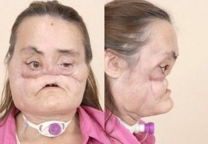 connie-culp-initial-face connie-culp-initial-face